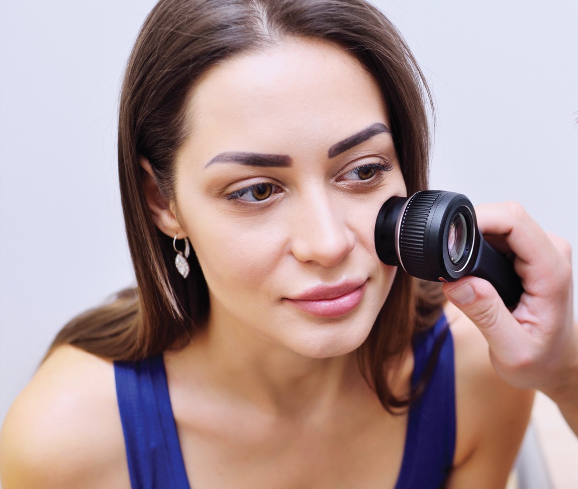 PREVENIRE IL MELANOMA
